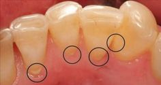 Helps whiten teeth a